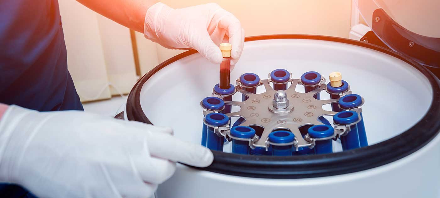 Injection PRP à Montpellier par le dr Montaigne